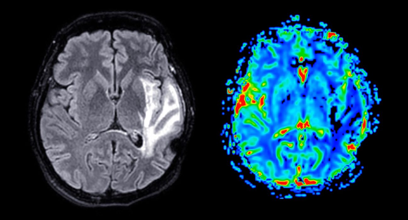 Ce que le foot fait à votre cerveau, en temps réel