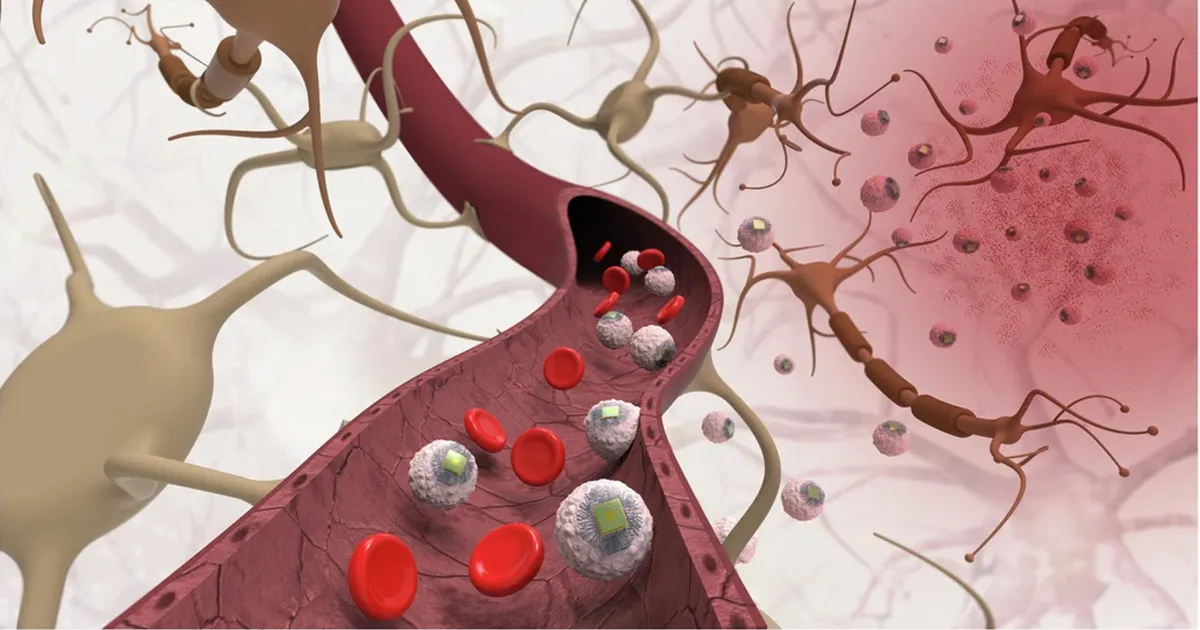 Le MIT met au point des puces cérébrales injectables