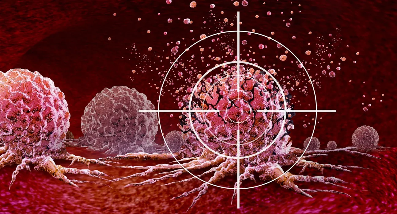 Neutraliser une protéine clé pourrait stopper net le cancer du poumon