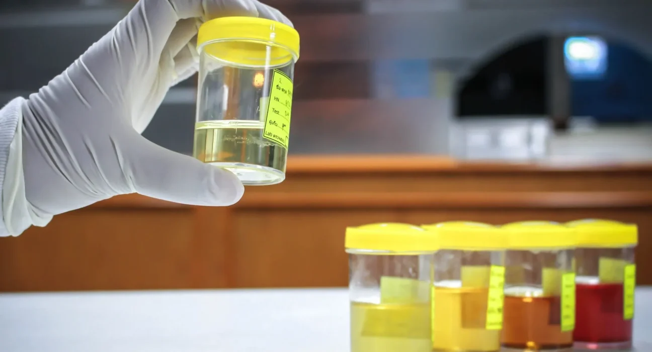 Découverte alarmante dans les échantillons d'urine humaine : 'Un classement urgent s'impose'