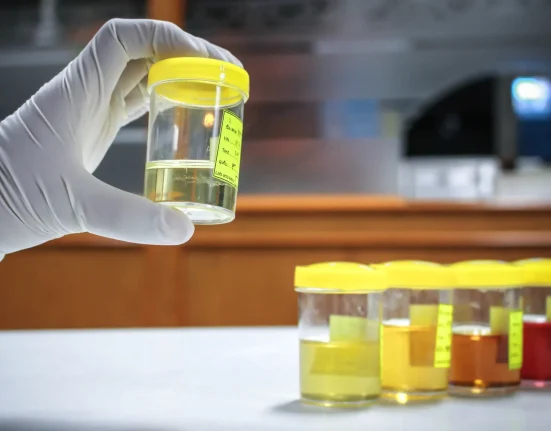 Découverte alarmante dans les échantillons d'urine humaine : 'Un classement urgent s'impose'