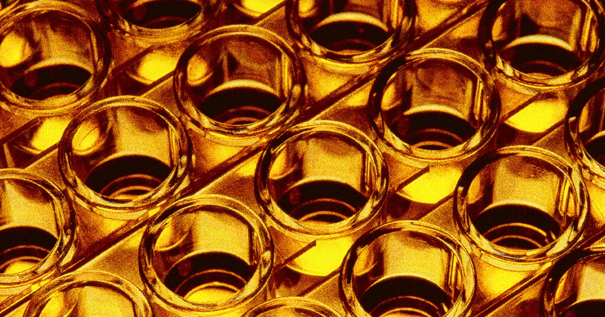 Des chercheurs analysent votre urine et dévoilent enfin des réponses.