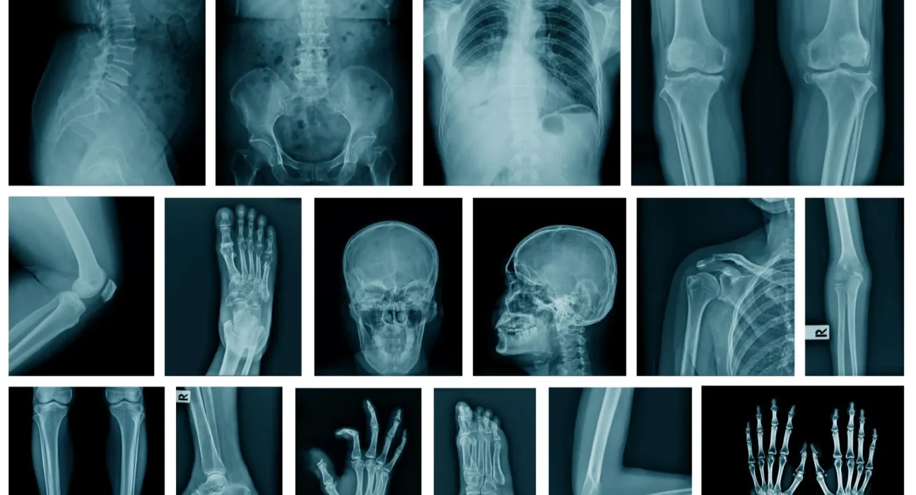 Des experts mettent en garde : notre réponse au stress comparée à celle face à des lions