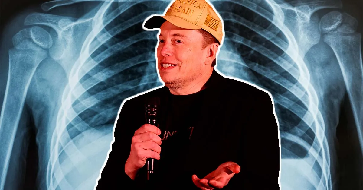 Elon Musk Suggère d'Intégrer Vos Scanners Médicaux à Son IA Grok