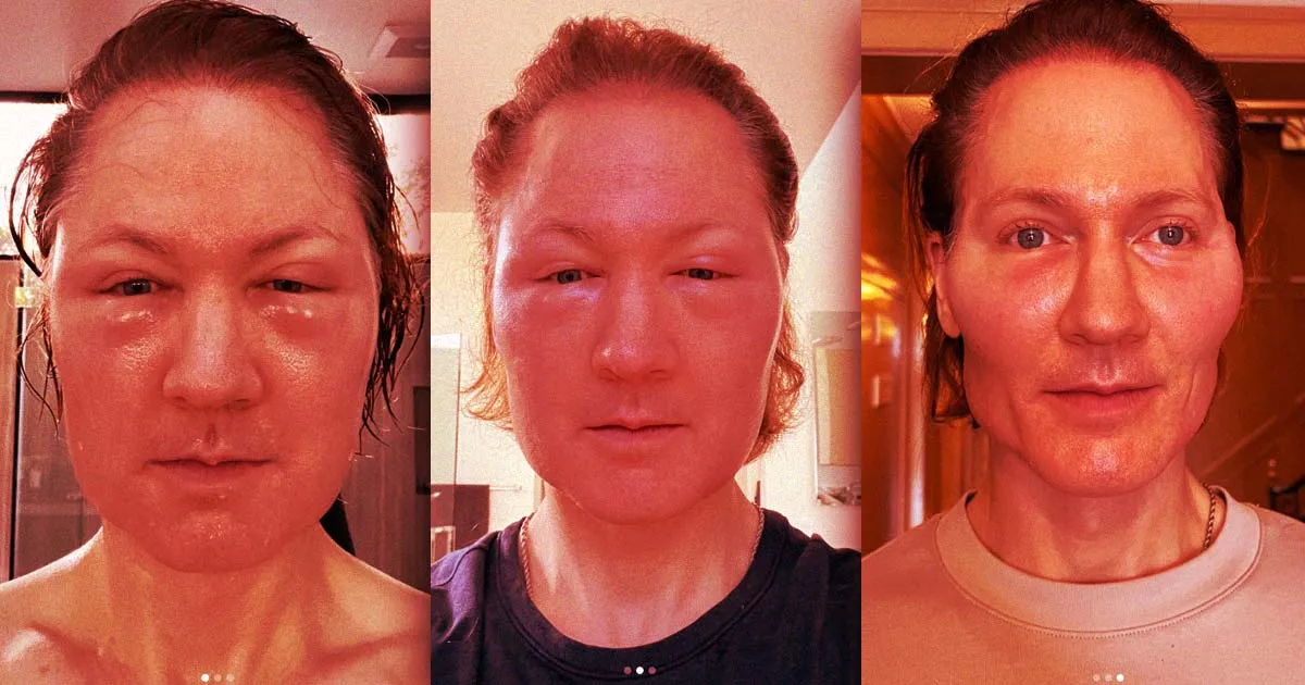 Un CEO de l'Anti-Vieillissement Subit Un Traitement Insolite, Réaction Étrange à la Clé.