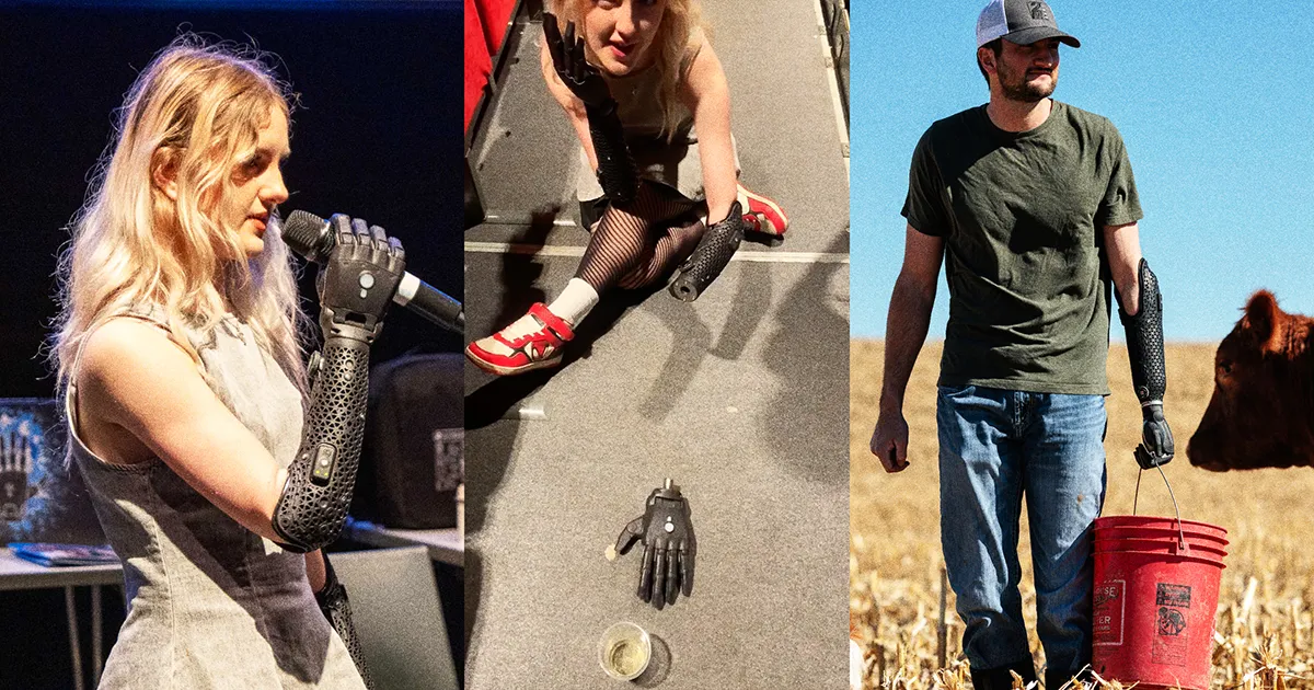 Une Main Bionique Innovante : Autonome, Mobile et Prête à Agir