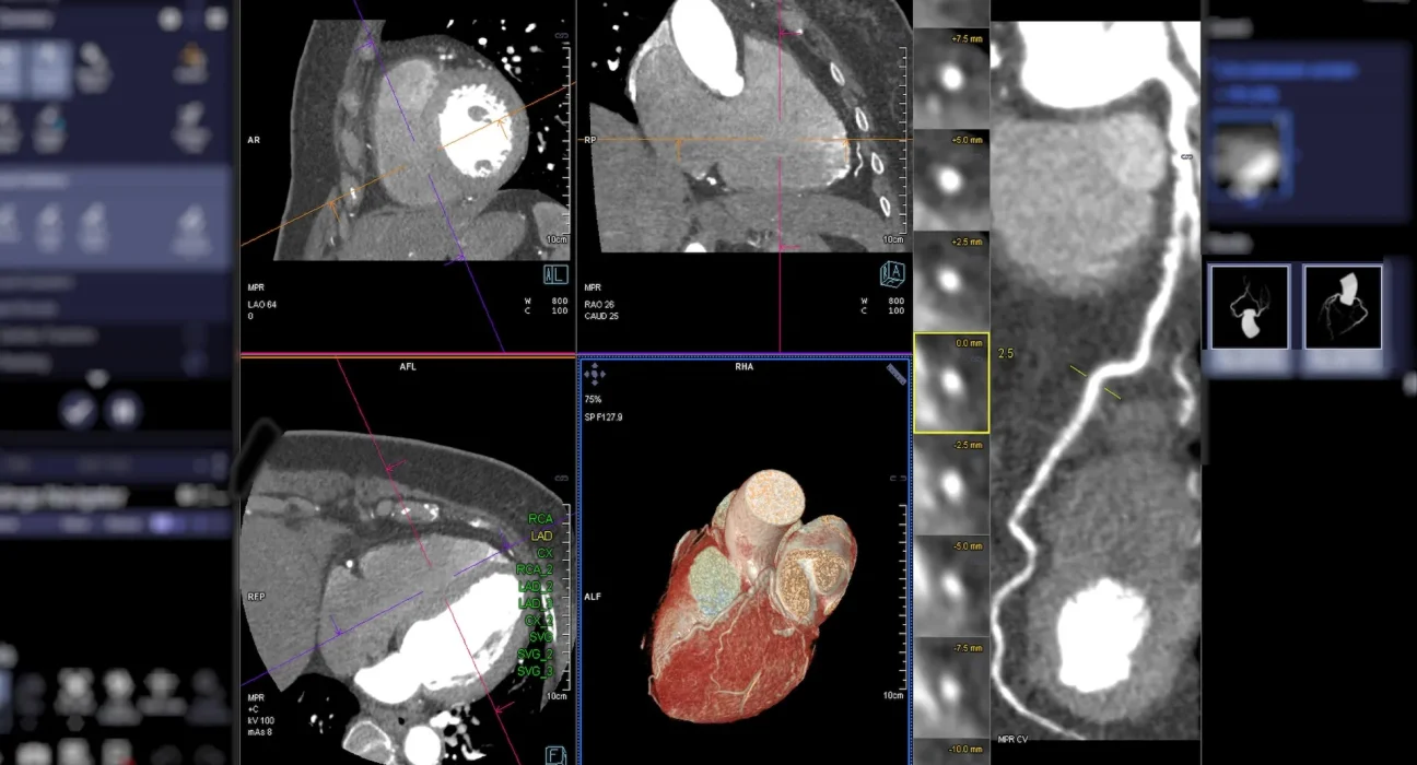 Alerte des chercheurs : une menace invisible peut provoquer des maladies cardiaques sévères, même à faibles niveaux d'exposition.