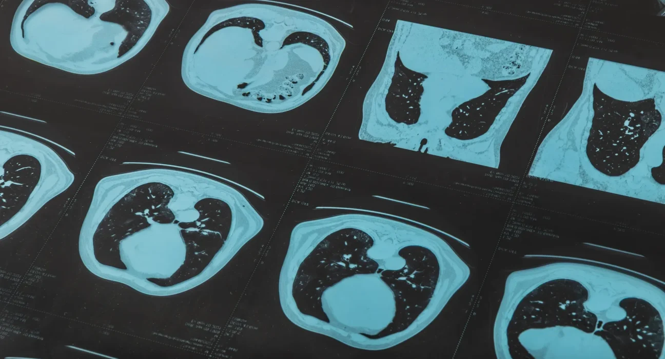 « Découverte troublante dans le corps humain : une révélation qui bouleverse nos certitudes »