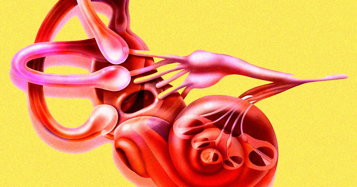 Des Médecins Explorent la Thérapie Génique pour Traiter une Forme de Surdité.