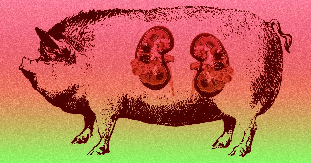 Des médecins réalisent la première transplantation rénale d'un porc chez un humain.