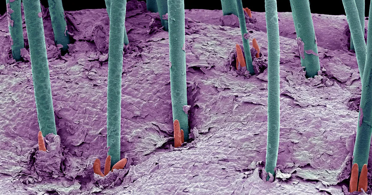 Des scientifiques cultivent des cheveux humains sur des souris pour les transplanter aux personnes chauves.