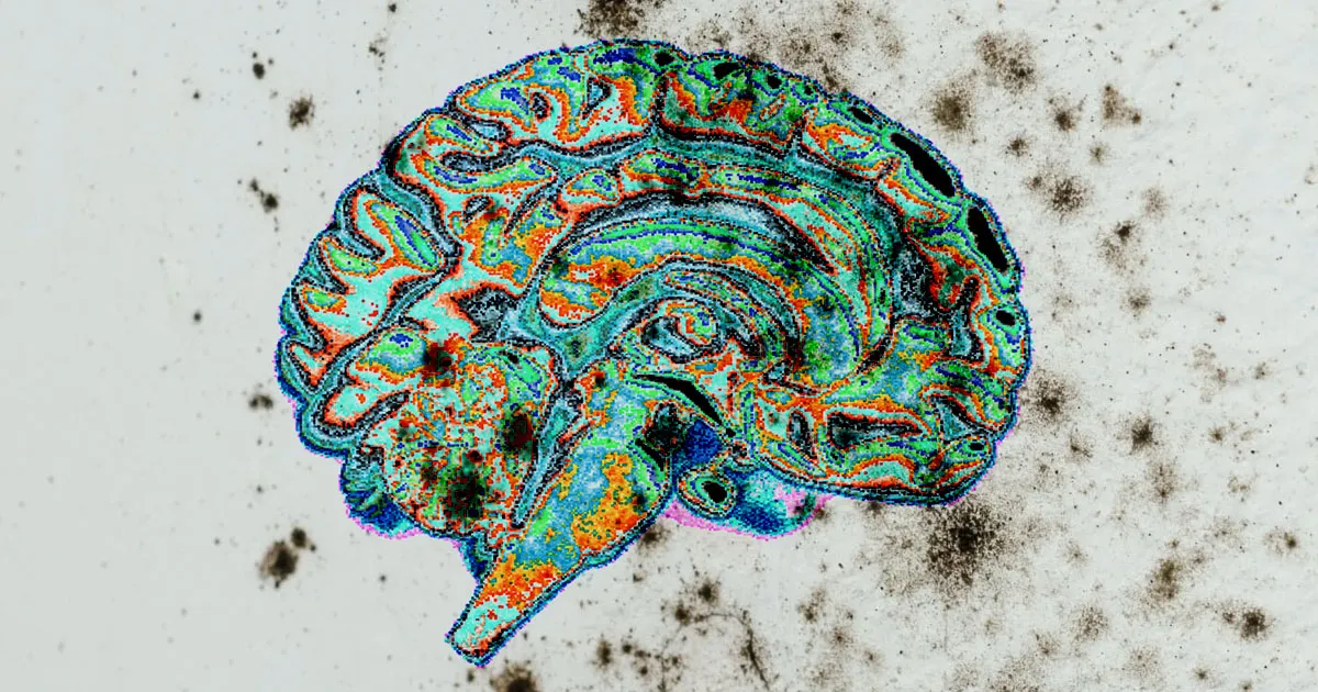 Un Homme Inquiet Découvre de la Moisissure Noire sur son Cerveau