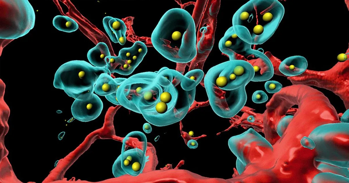 Des Médecins Utilisent un Virus pour Provoquer l'Auto-Déstruction des Tumeurs