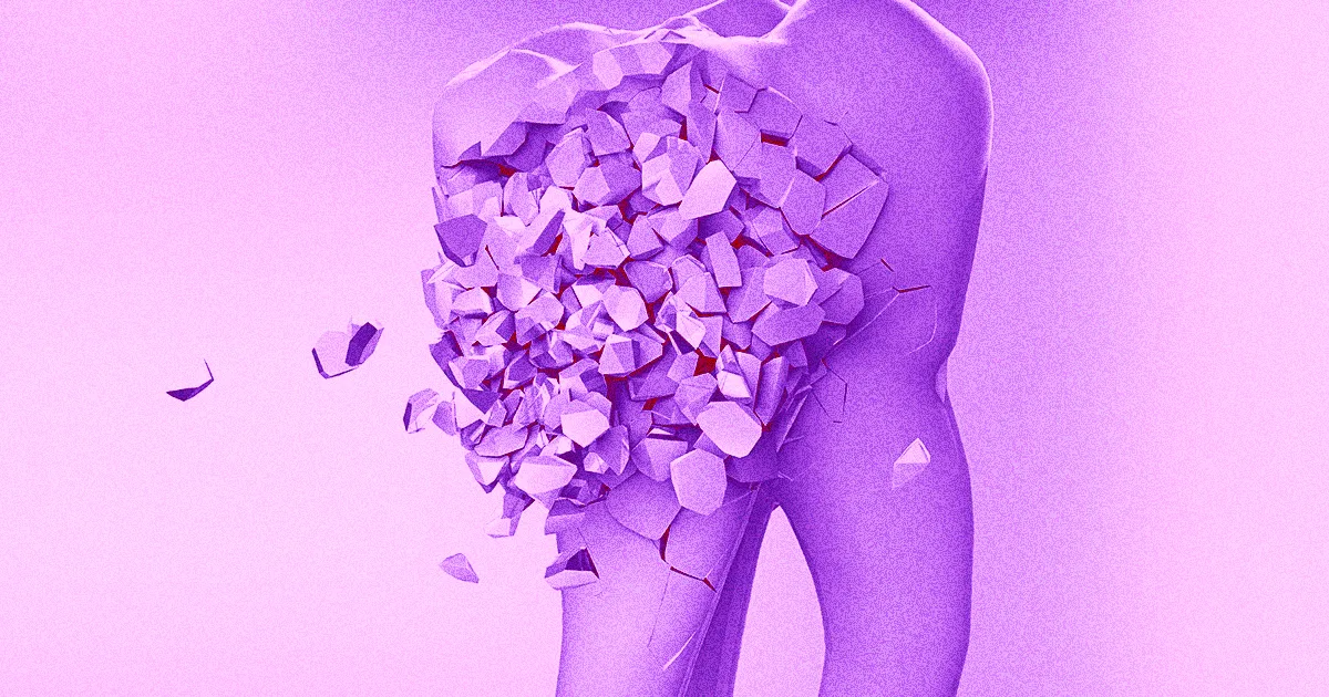Des Scientifiques Dévoilent des Bonbons Réparateurs pour l'Émail Dentaire