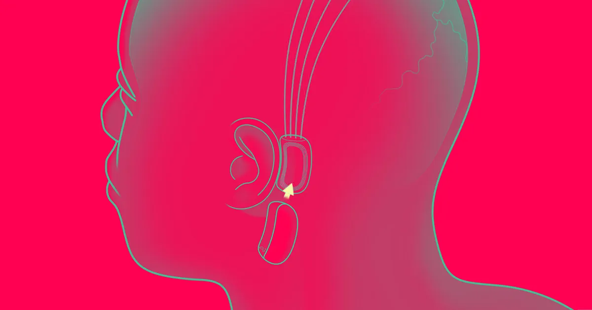 Implants Humains de Neuralink Prévus pour la Fin de l'Année, Annonce Elon Musk