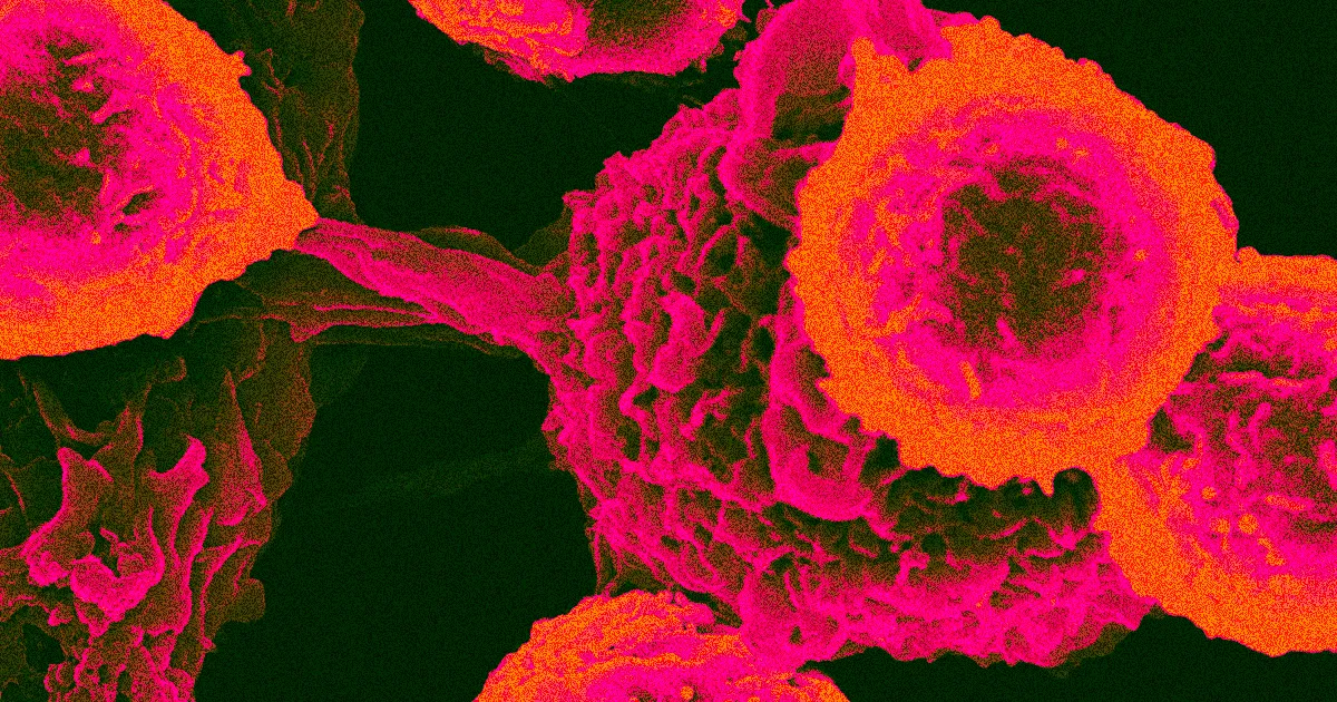 Les Médecins Découvrent une Protéine Reliant Tous les Types de Cancer