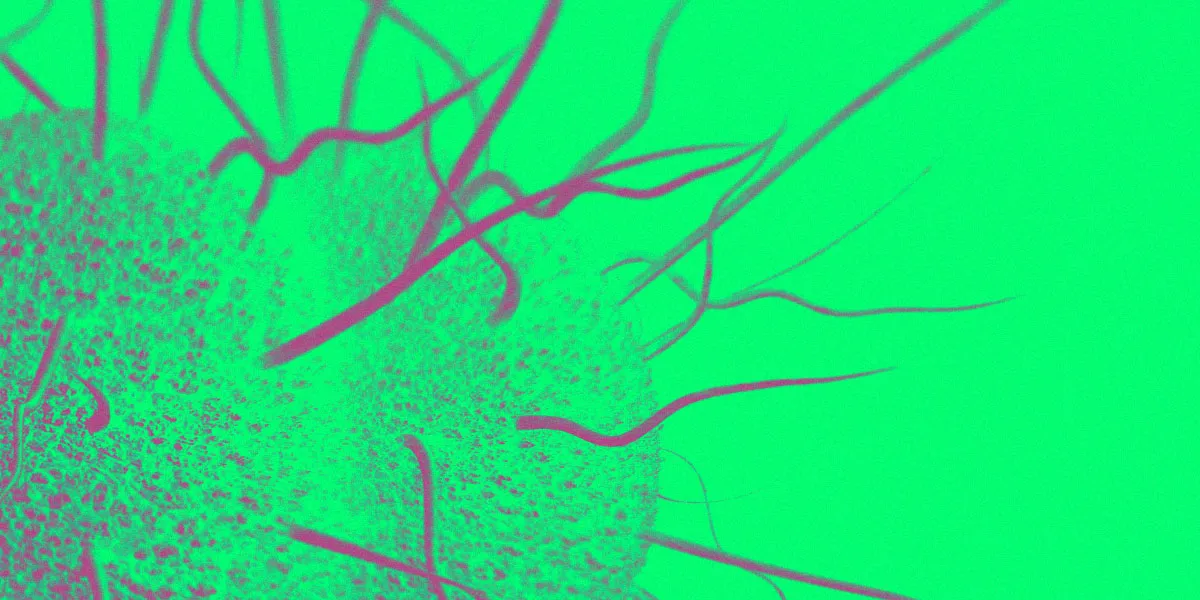 Les Médecins Inquiets d'une Augmentation Majeure des IST après la Pandémie