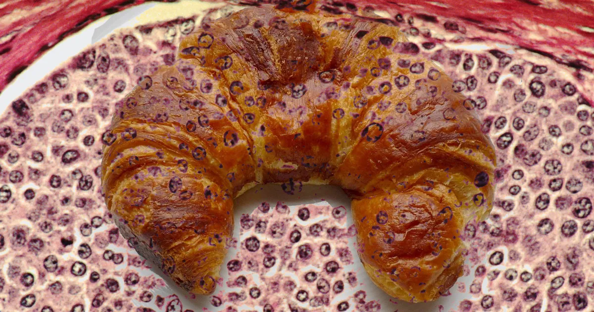 Une IA Conçue pour Distinguer les Pâtisseries Excelle dans la Détection du Cancer.