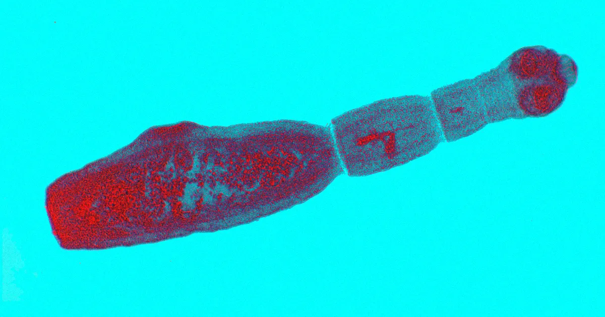 Une Parasite Effrayant Se Propague des Chiens aux Humains.