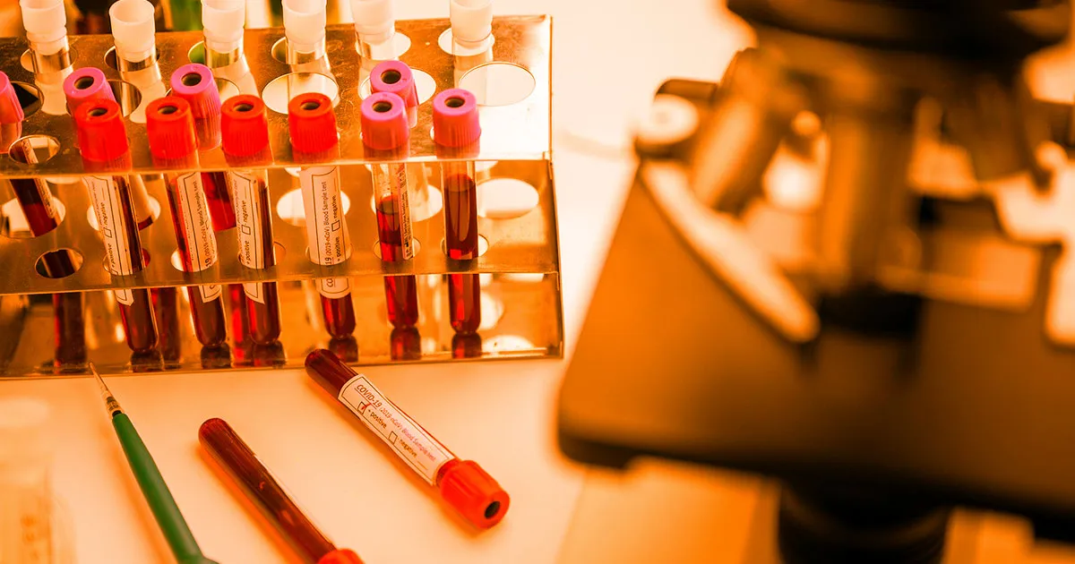 Ce vaccin contre la COVID-19 pourrait être disponible dès septembre.