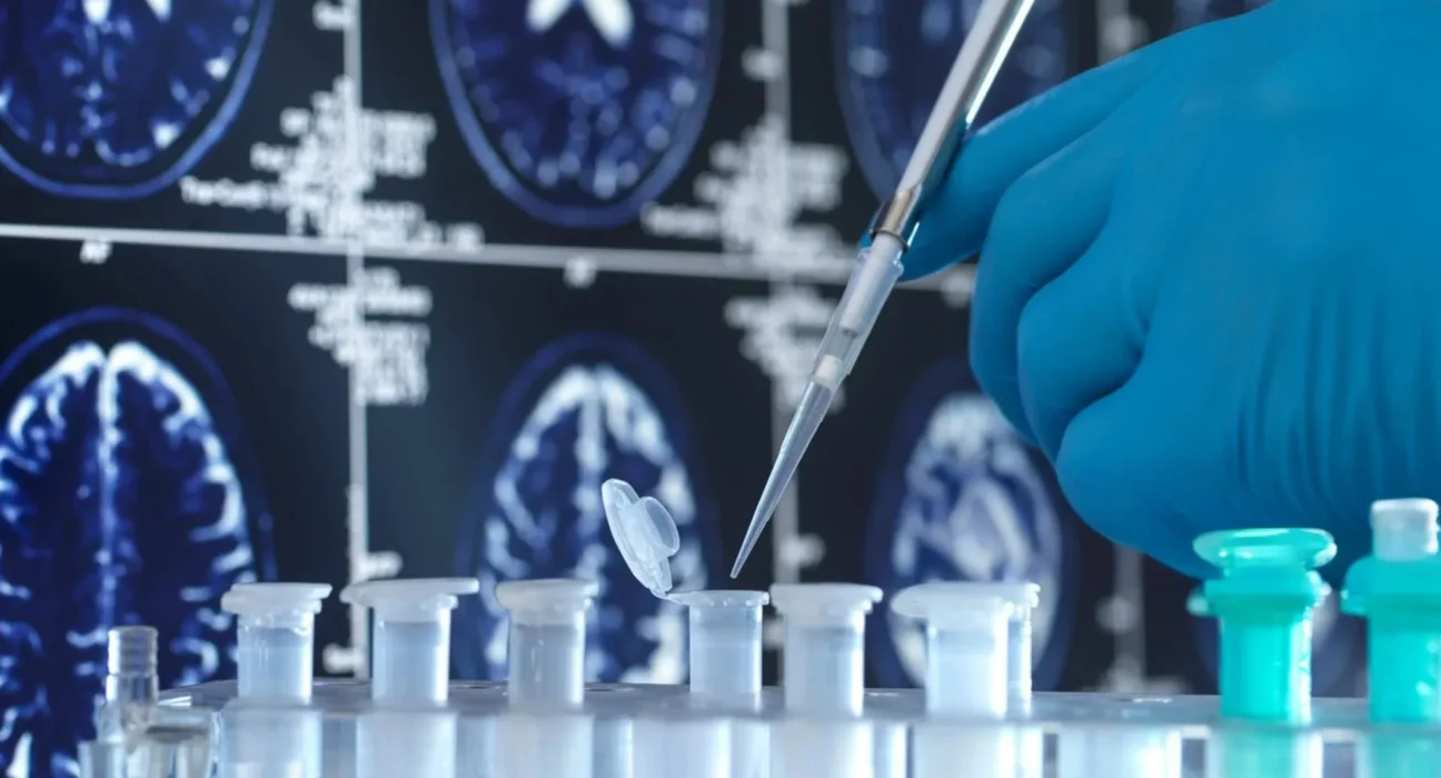 Des chercheurs font une découverte troublante en étudiant des cerveaux humains donnés : 'Est-ce encore plus grave que prévu ?'