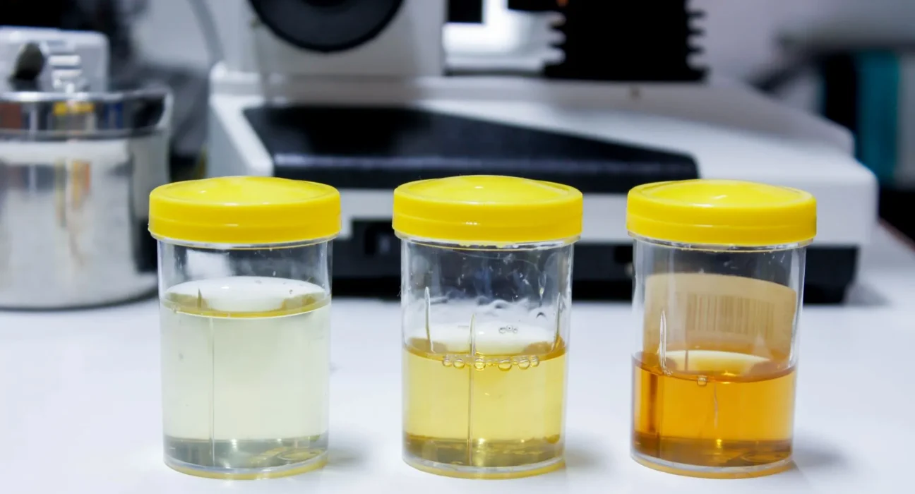 Des chercheurs transforment l'urine en avancée révolutionnaire pour les piles à hydrogène.