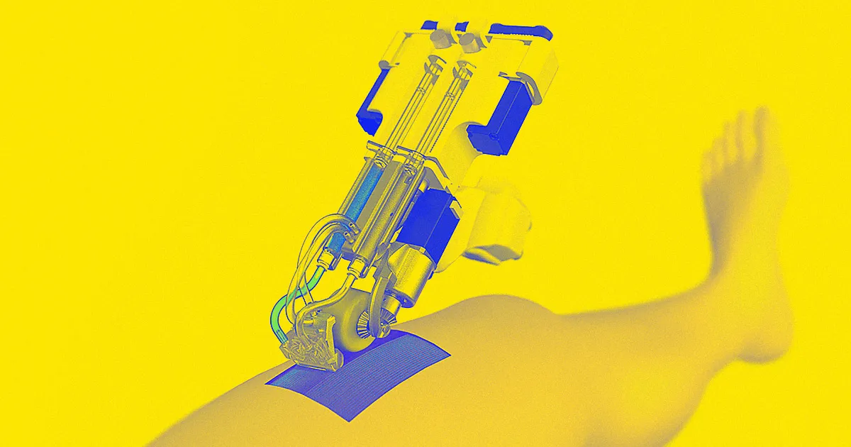 Dispositif Portable : Impression Directe de Peau sur les Plaies