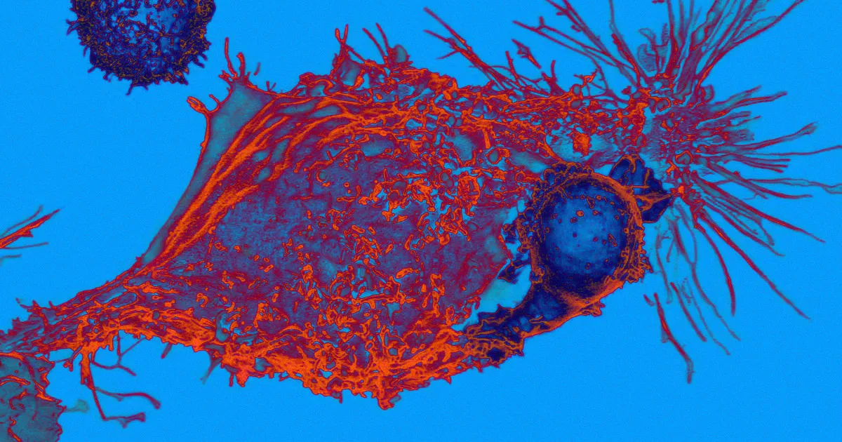 Essai Cliniques Prouve le Potentiel de CRISPR Comme Traitement contre le Cancer
