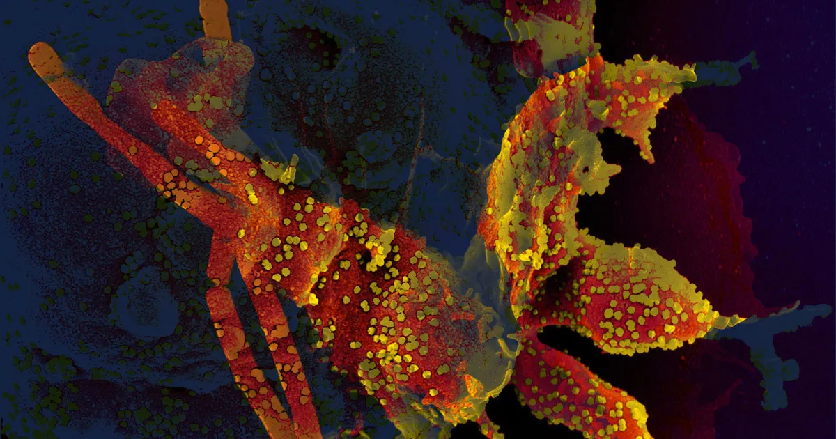 Excellente Nouvelle : Le Corps Humain Développe une Réponse Immunitaire Solide contre la COVID