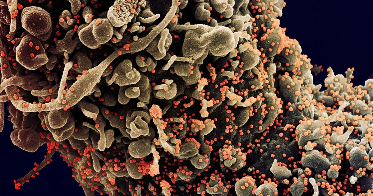 Fauci : Le Virus N'est Pas D'origine Laboraoire, Réveillez-vous !