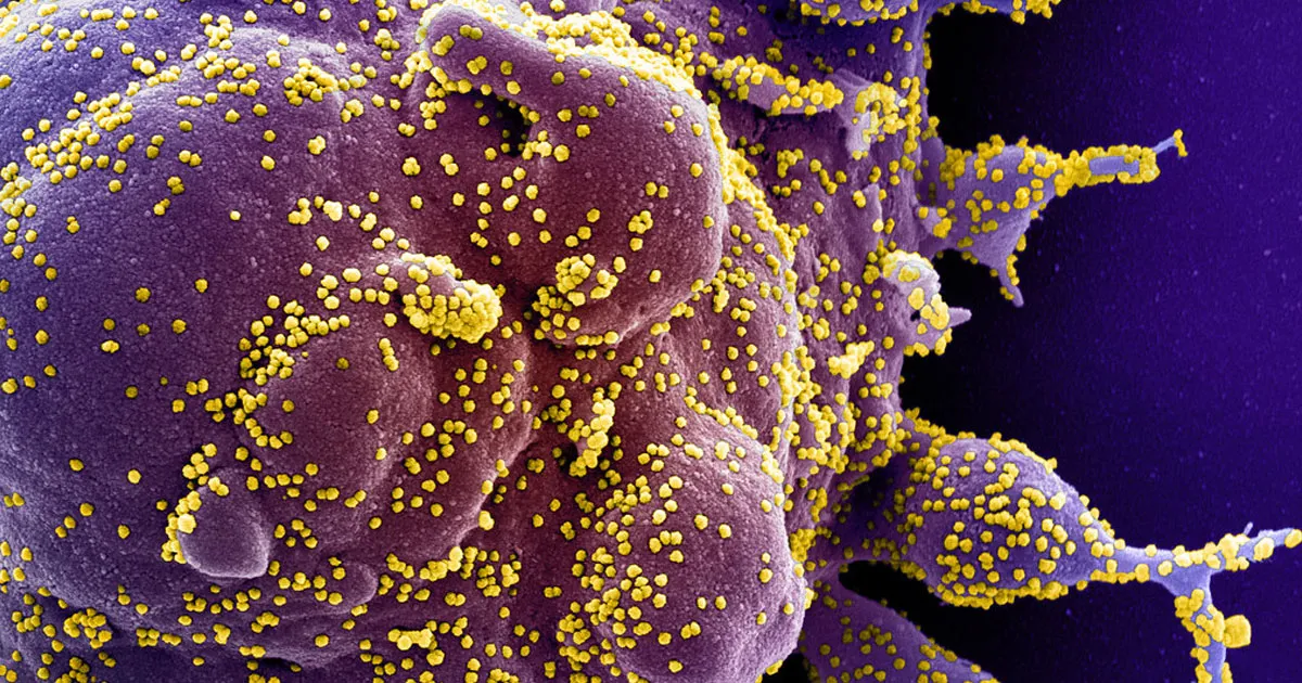 Impact Inégal du Coronavirus sur les Communautés Noires