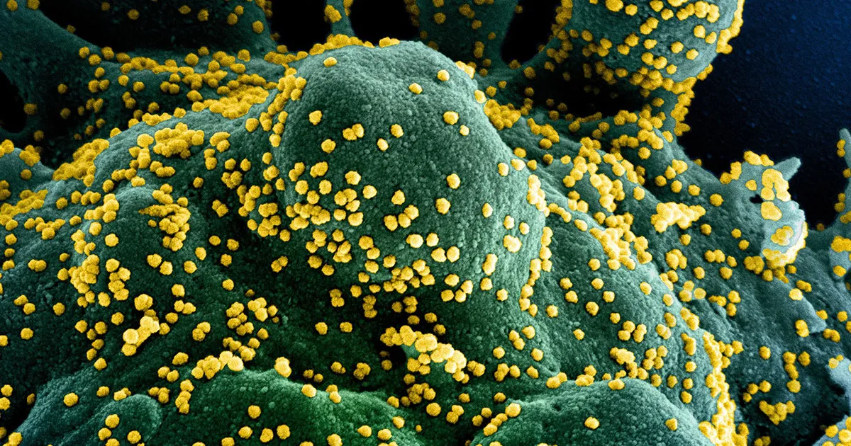 L'OMS : Le Coronavirus pourrait s'installer durablement