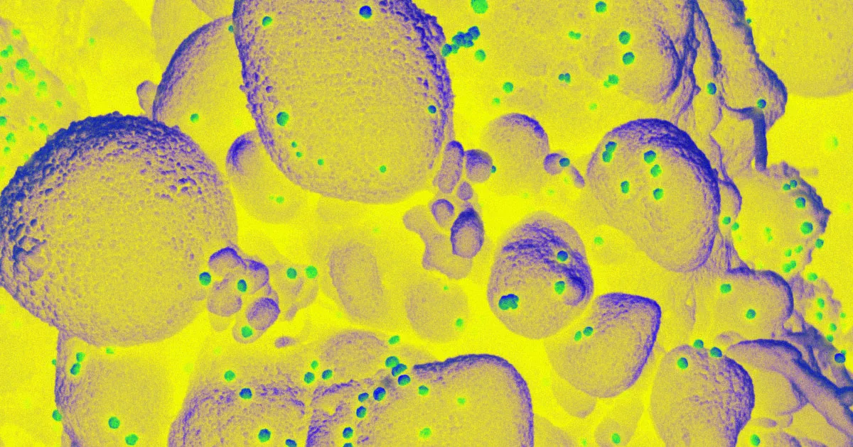 Le Coordinateur des Manifestations Anti-Quarantine Contaminé par le Coronavirus