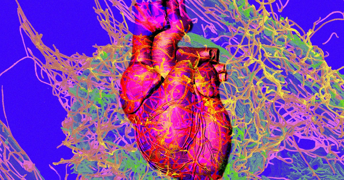 Les Patients COVID-19: Un Risque Croissant de Décès par Arrêt Cardiaque