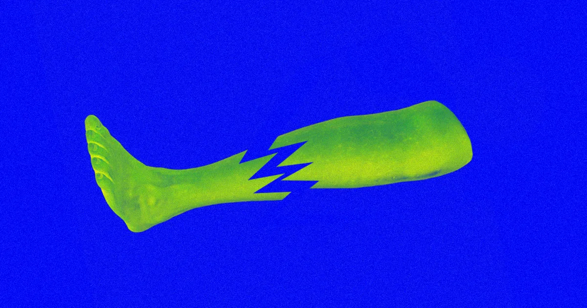 Rêvez de Grandeur ? Chirurgie Révolutionnaire pour Allonger Vos Jambes Durable