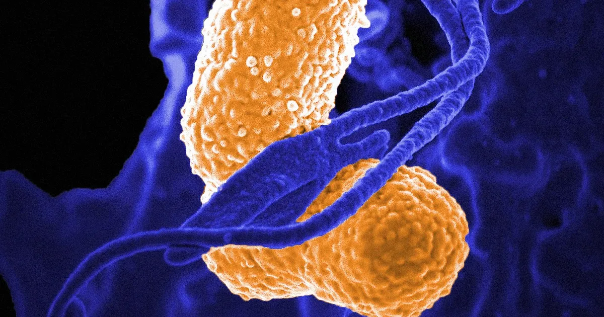Une Épidémie Étrange Frappe la Chine.
