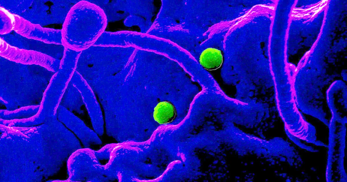 Virus Chinois Mystérieux et Mortel : Son Arrivée Officielle aux États-Unis