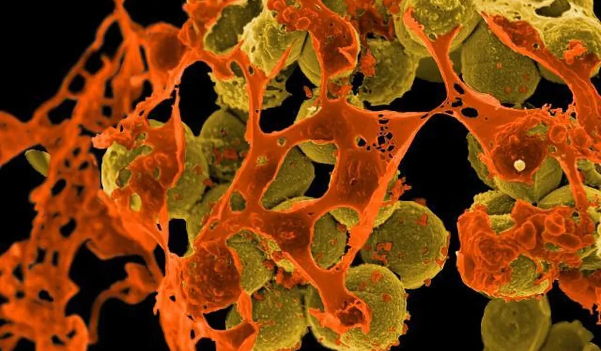 Bactéries Humaines : Un Rempart Inattendu Contre le Cancer de la Peau
