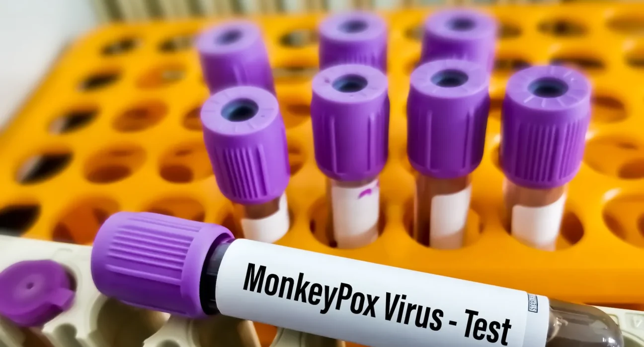 CDC suspend les tests de la rage et de la variole pour les départements de santé publics locaux et étatiques.