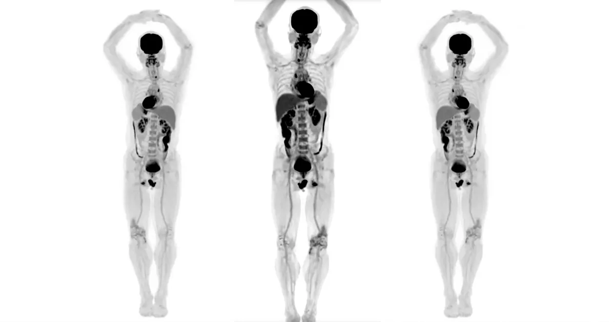 Découvrez les Images 3D Révolutionnaires du Premier Scanner Médical Corps Complet.