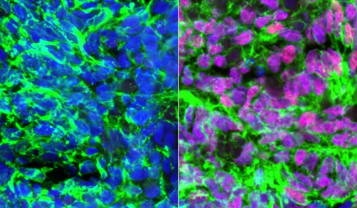 Des Scientifiques Transforment des Cellules Souches Humaines en Neurones Tactiles.