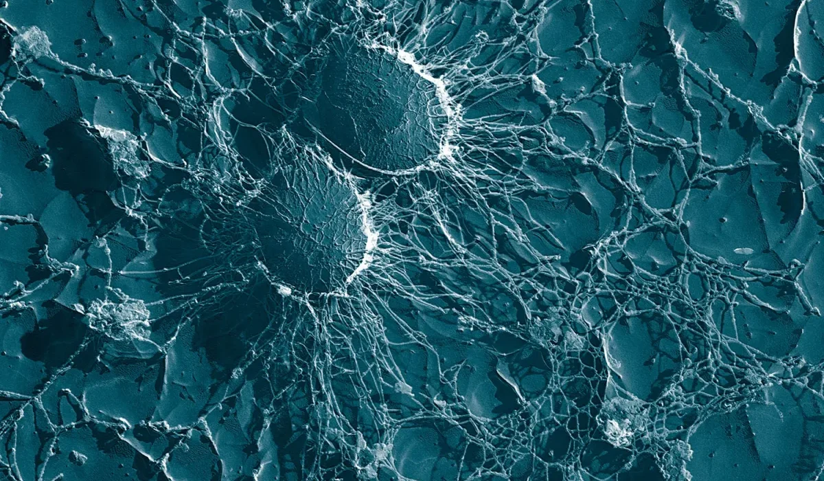 Des bactéries méconnues sous nos pieds : une nouvelle arme contre les superbugs.