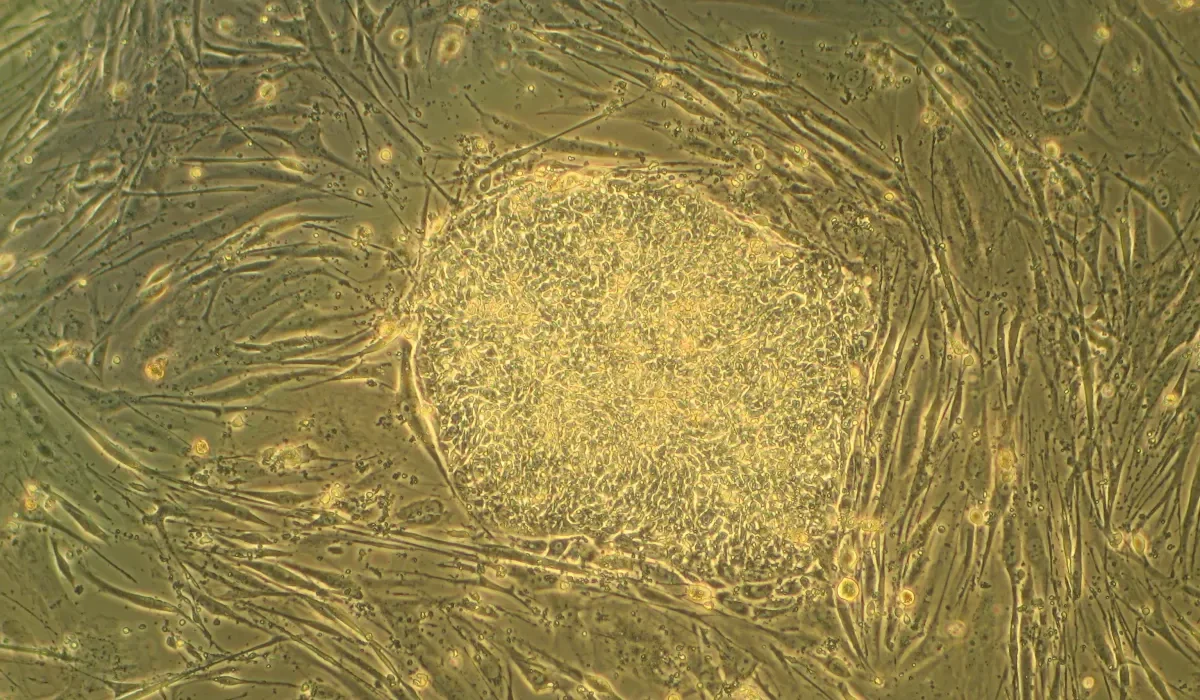 Des scientifiques cultivent pour la première fois un muscle humain fonctionnel à partir de cellules souches.