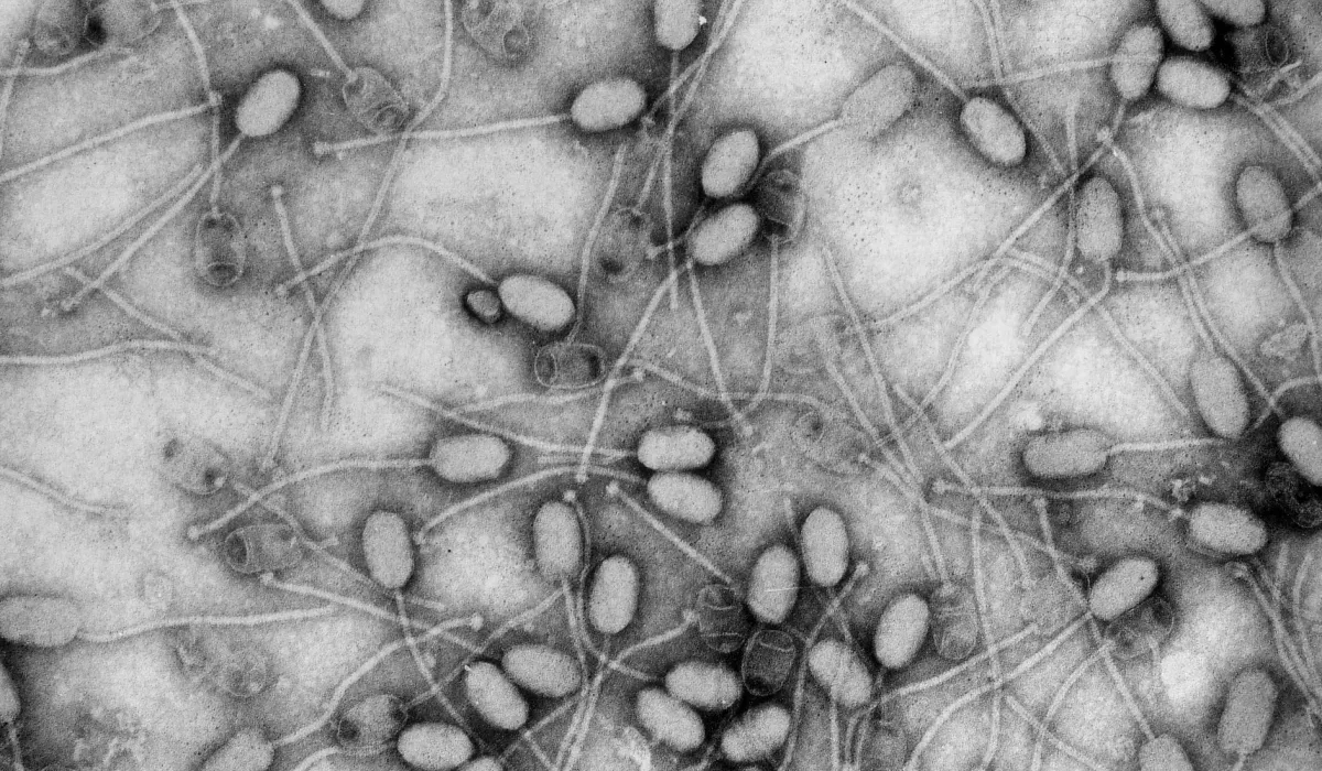 L'Intelligence Artificielle : Une Arme Contre les Supervirus et les Superbactéries.