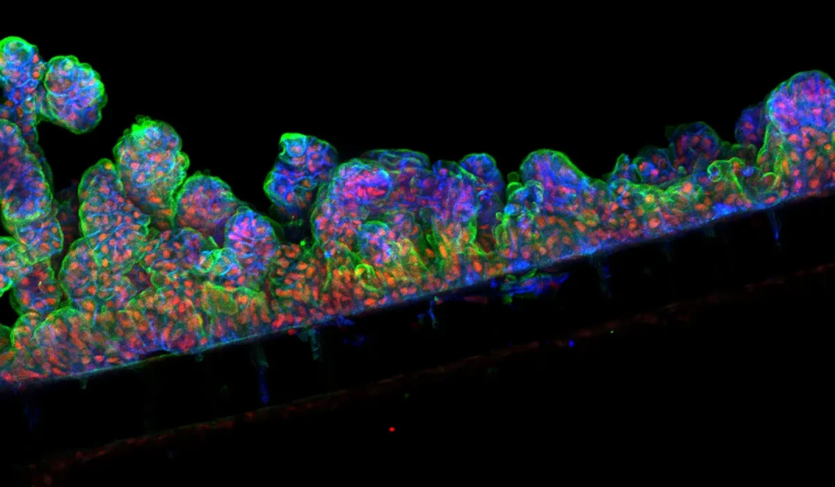 Le Chip Intestinal : Une Nouvelle Lueur pour les Patients Atteints de Maladies comme la Maladie de Crohn