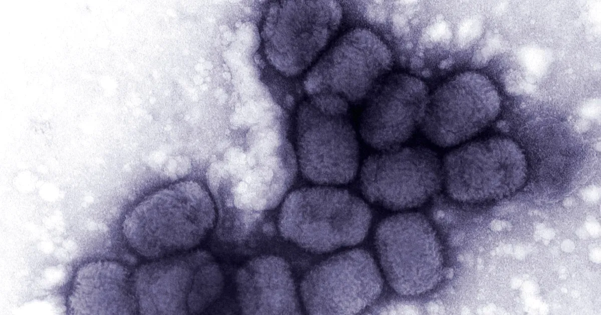 Les microbiologistes s'inquiètent fortement de la synthèse du virus de la variole.
