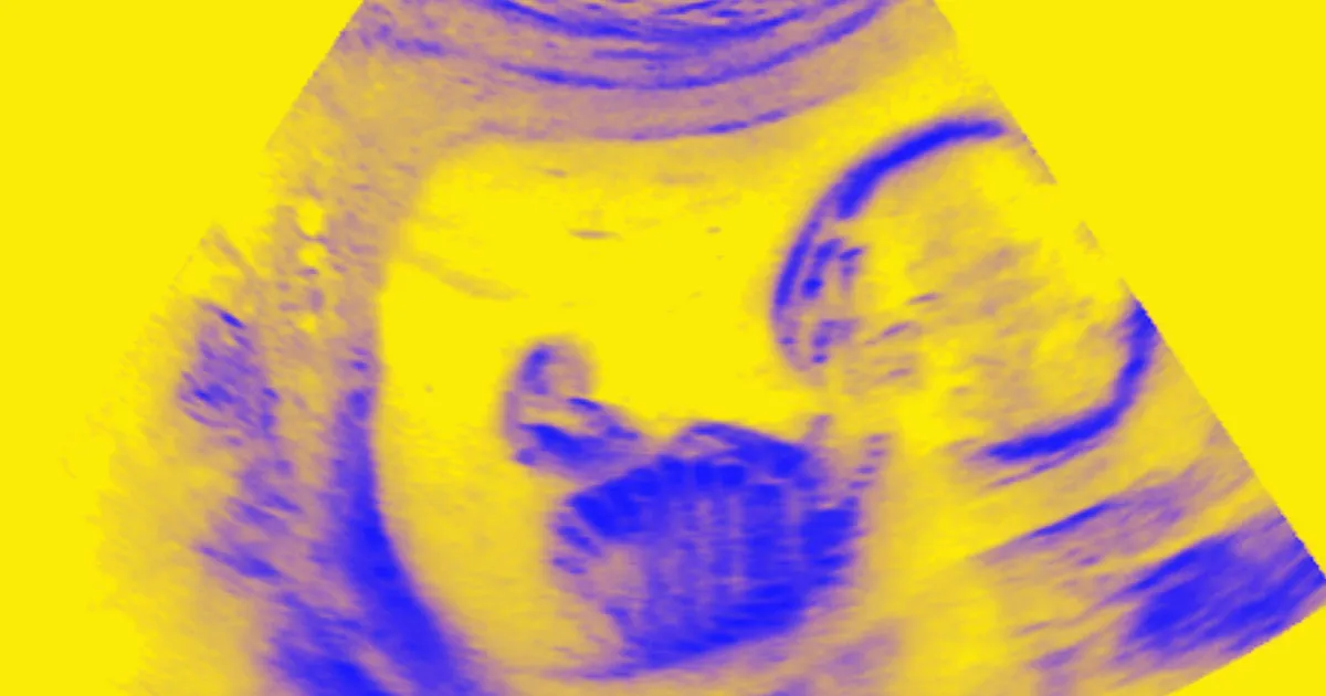 Naissance Imminente du Troisième Bébé Modifié: Les Scientifiques en Effervescence