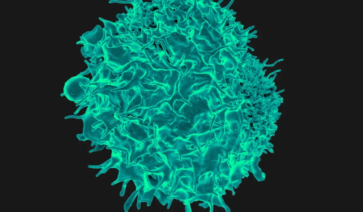 Nouvelles Études CAR-T sur le Cancer : Espoir pour les Patients sans Autres Solutions