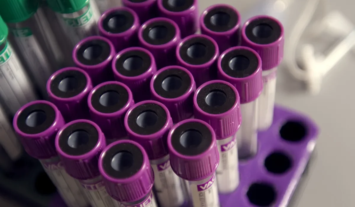 Un Test Sanguin Révolutionnaire pour Détecter les Commotions Cérébrales Plus Rapidement