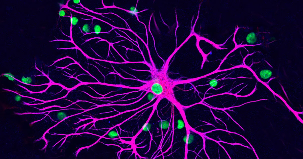 Une Nouvelle Étude Pourrait Freiner la Sclérose en Plaques.